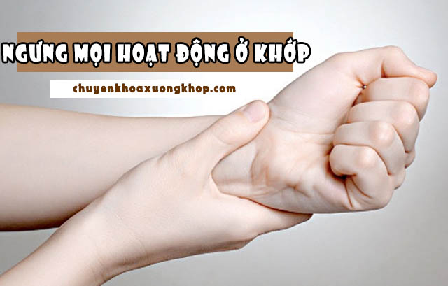 Ngưng hoạt động ở khớp tổn thương là cách trị bong gân hiệu quả