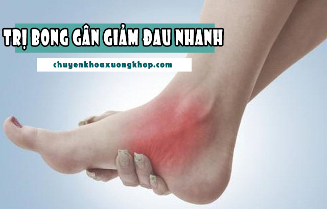 Cách trị bong gân