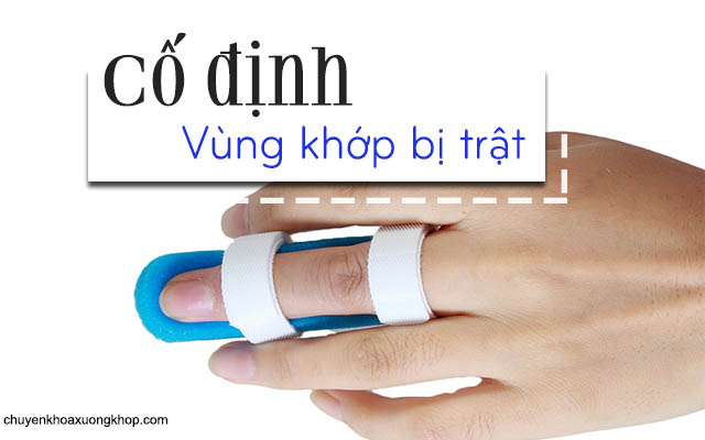 cố định khớp để điều trị trật khớp