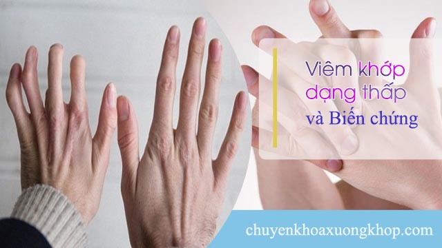 biến chứng của viêm khớp dạng thấp