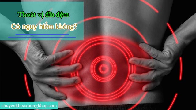 Thoát vị đĩa đệm cột sống có gây nguy hiểm