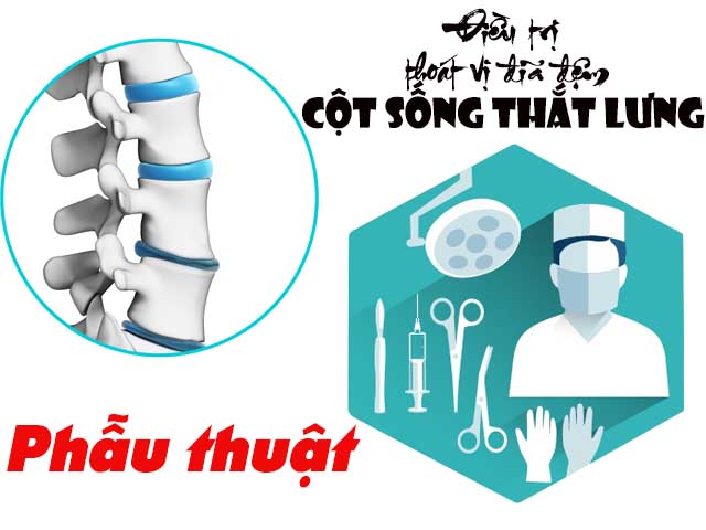 Phẫu thuật chữa thoát vị đĩa đệm cột sống thắt lưng