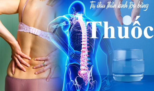 Điều trị đau thần kinh tọa bằng thuốc