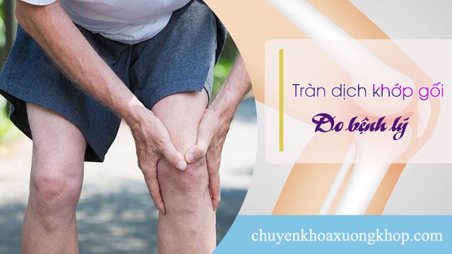 tràn dịch khớp gối do bệnh lý