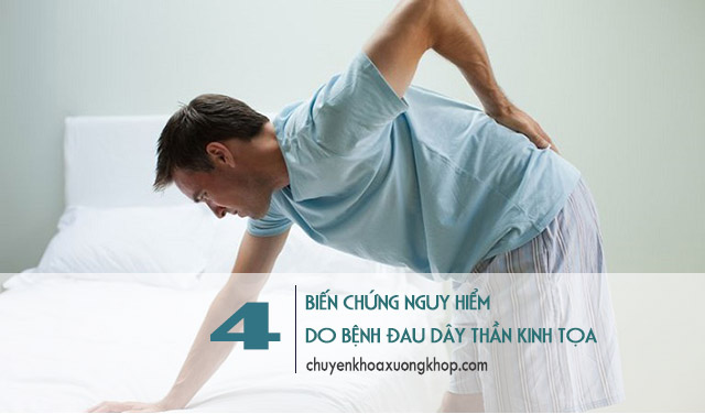 biến chứng của bệnh đau dây thần kinh tọa