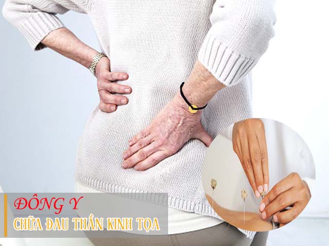 chữa đau thần kinh tọa bằng đông y