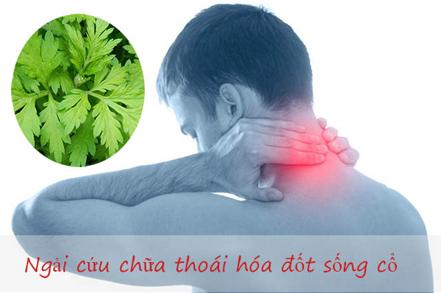 Ngải cứu chữa bệnh thoái hóa đốt sống cổ