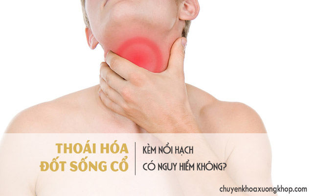 Thoái hóa đốt sống cổ kèm nổi hạch có nguy hiểm không