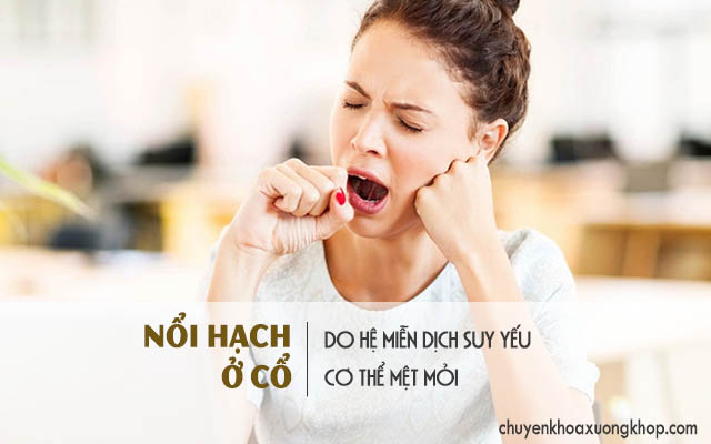 Nổi hạch ở cổ do sức đề kháng suy yếu