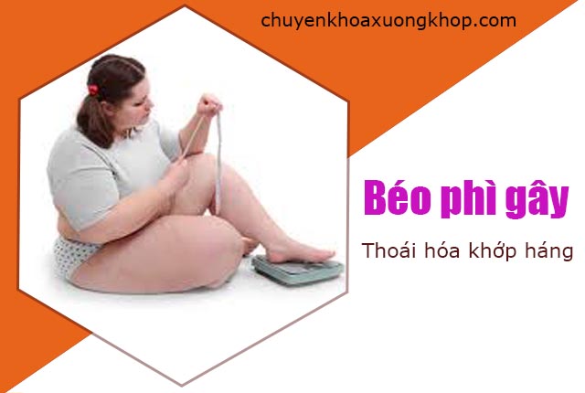 béo phì gây thoái hóa khớp háng