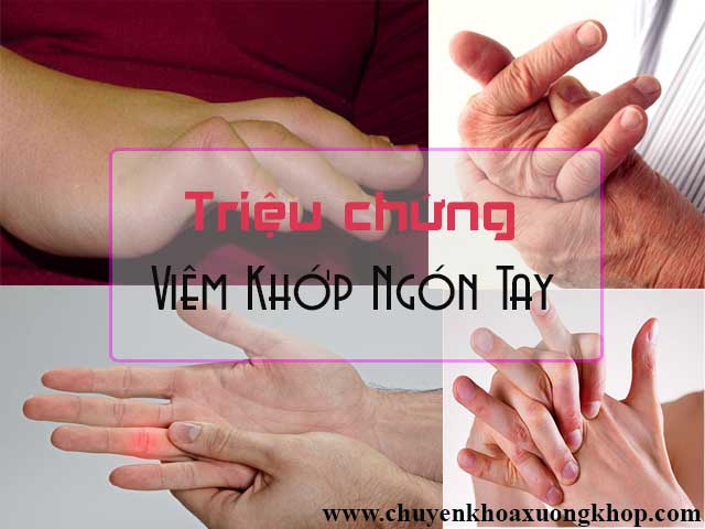 Triệu chứng bệnh viêm khớp ngón tay