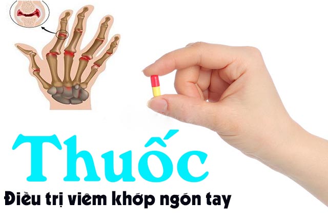 Thuốc điều trị viêm khớp ngón tay