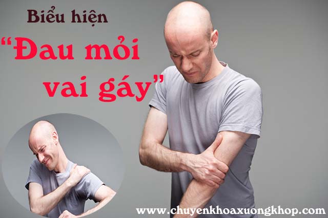 Biểu hiện đau mỏi vai gáy