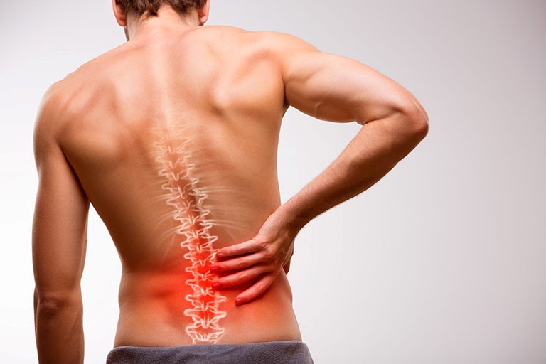 Bệnh đặc trưng bởi cơn đau xuất hiện ở vùng thắt lưng, đau âm ỉ, dai dẳng và có tính chất cơ học