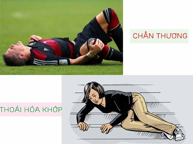 chấn thương gây thoái hóa khớp