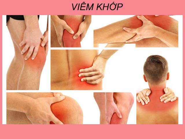 đau khớp là triệu chứng của viêm đa khớp dạng thấp