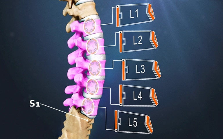 L3 L4 L5 là 3 đốt xương rất dễ tình trạng thoái hóa