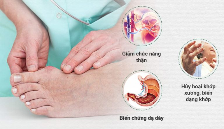 Thuốc Tây y cho tác dụng nhanh nhưng có thể gây nhiều biến chứng nguy hiểm